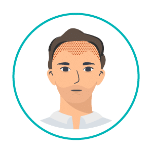 transplante-capilar-icon1 transplante-capilar-icon1