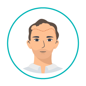 transplante-capilar-icon2 transplante-capilar-icon2